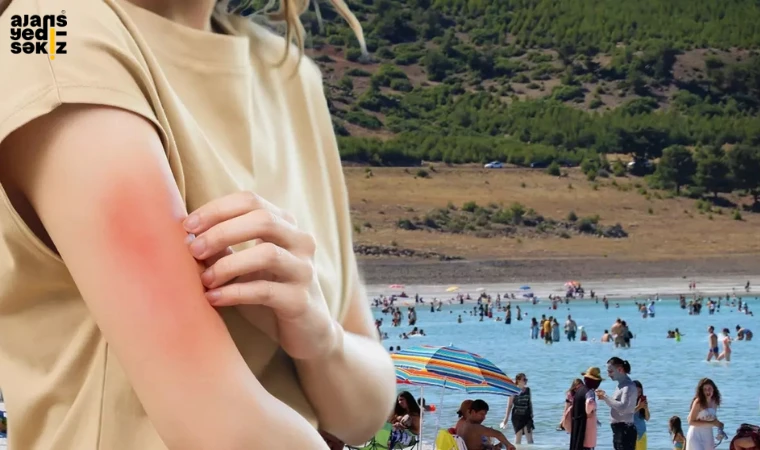Sağlık Bakanlığı, Vibrio vulnificus vakasına rastlanmadığını açıkladı.